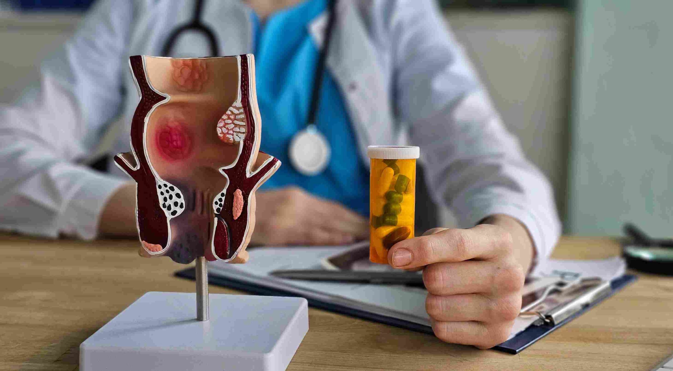 Lekar drži bočicu sa lekovima pored anatomskog modela koji prikazuje hemoroide